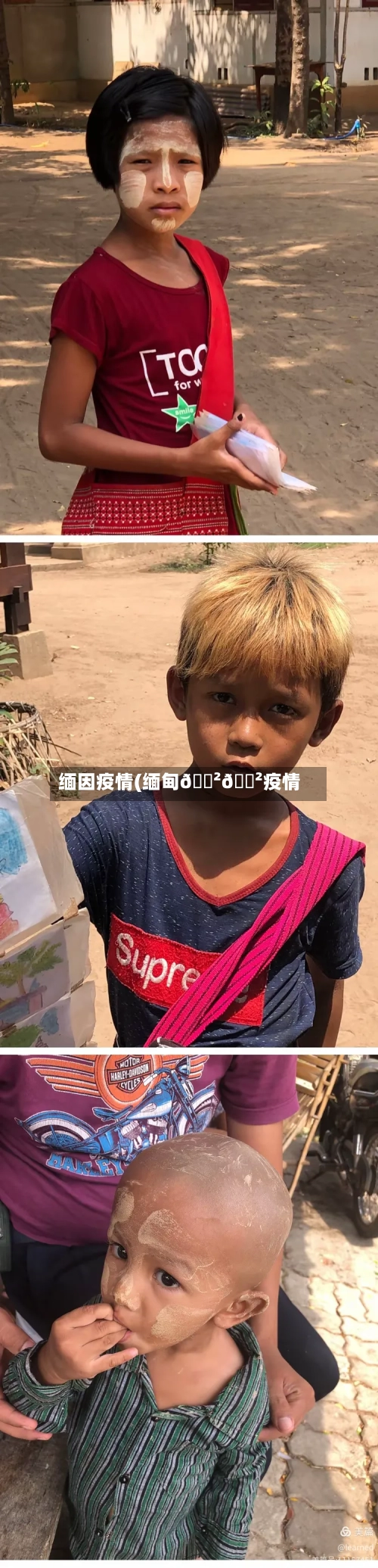 缅因疫情(缅甸🇲🇲疫情)
